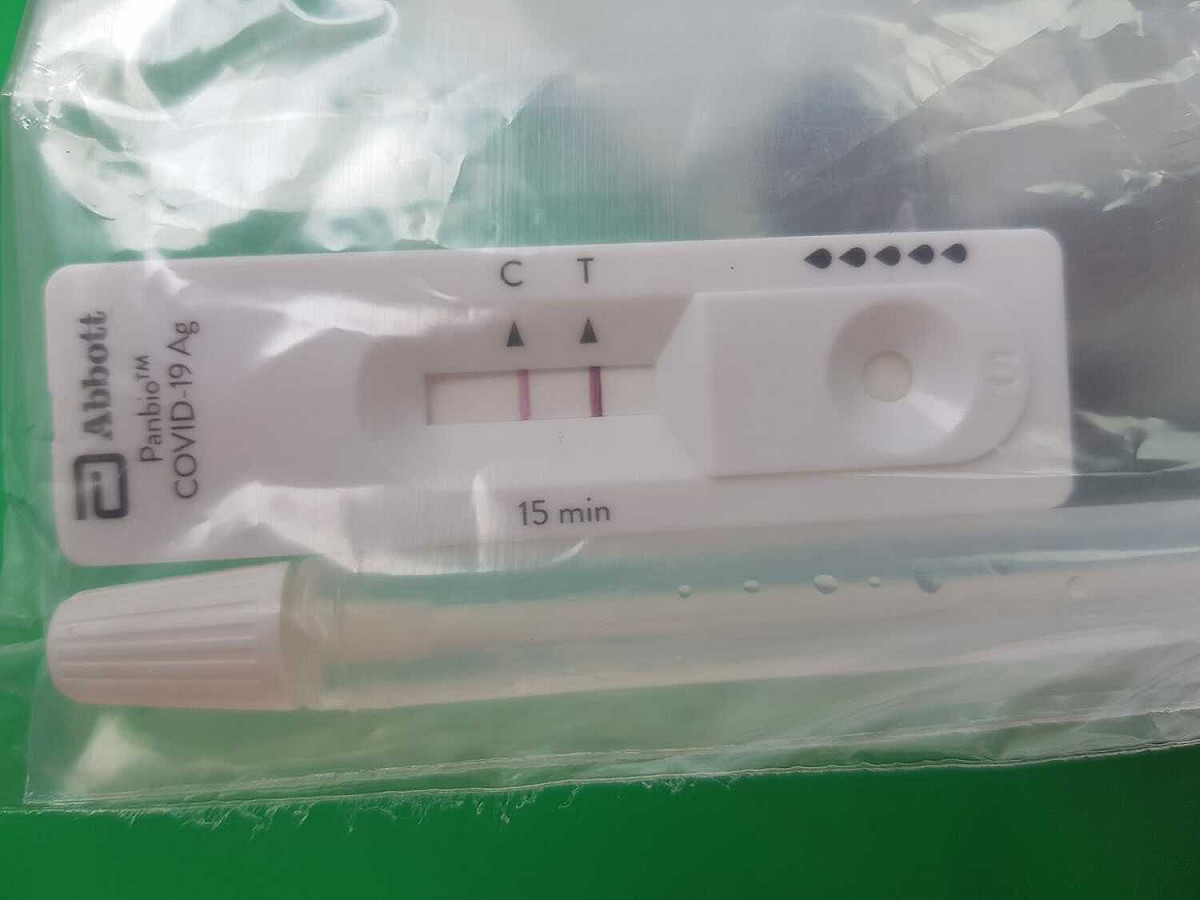 台北聯醫陽明院區胸腔科醫生蘇一峰今即在臉書專頁上貼出「快篩兩條線」的照片表示，他今天上班驗的第一個PCR就是陽性。 圖：翻攝蘇一峰臉書專頁