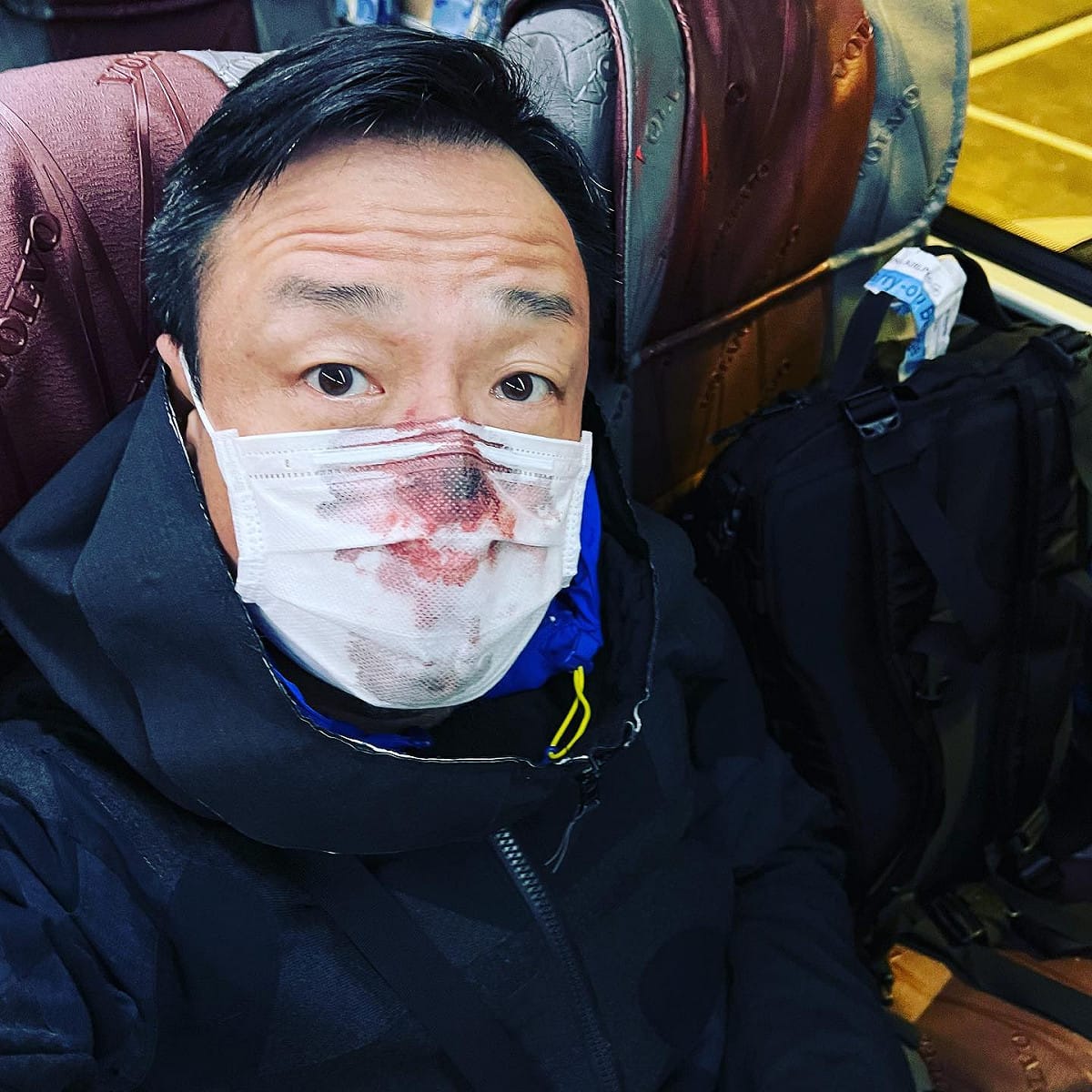 王喜指控醫護人員替他做PCR檢測時，將他捅到流鼻血，憤怒發出「通緝文」要該名採檢醫護給出交代。 圖：翻攝自王喜臉書