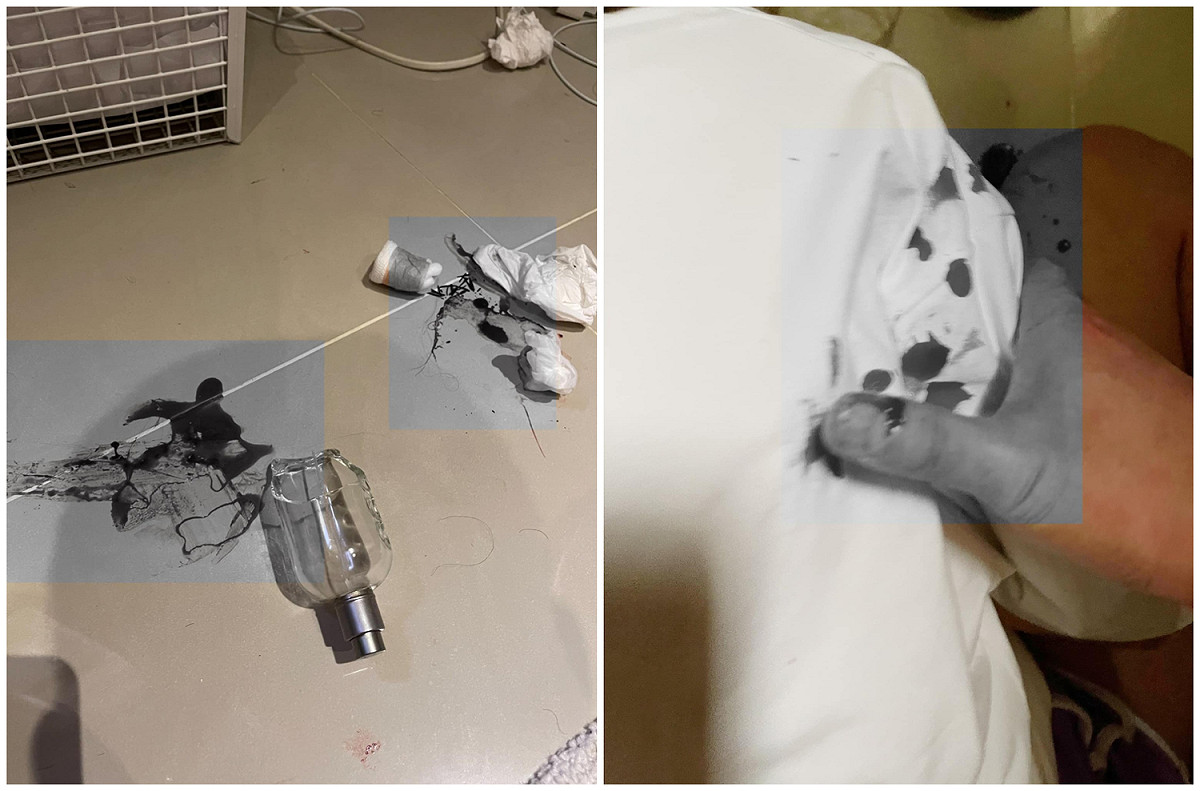 林曜晟反控遭女方咬到嚴重撕裂傷，還砸破香水瓶劃傷他的腳。 圖：翻攝自林曜晟臉書