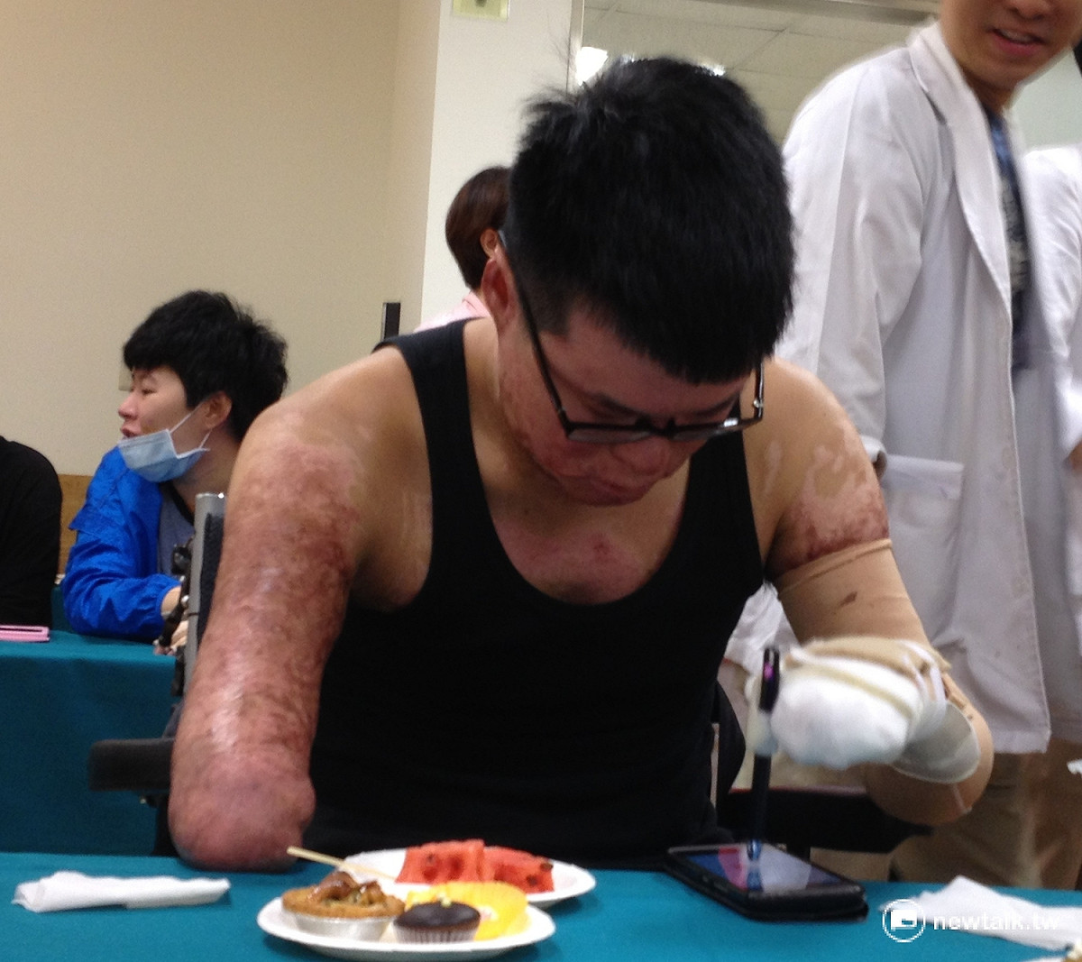經過1年復健過後，塵爆截肢傷患黃博煒的左手掌已可套上輔具用觸控筆滑手機。 圖：周富美/攝