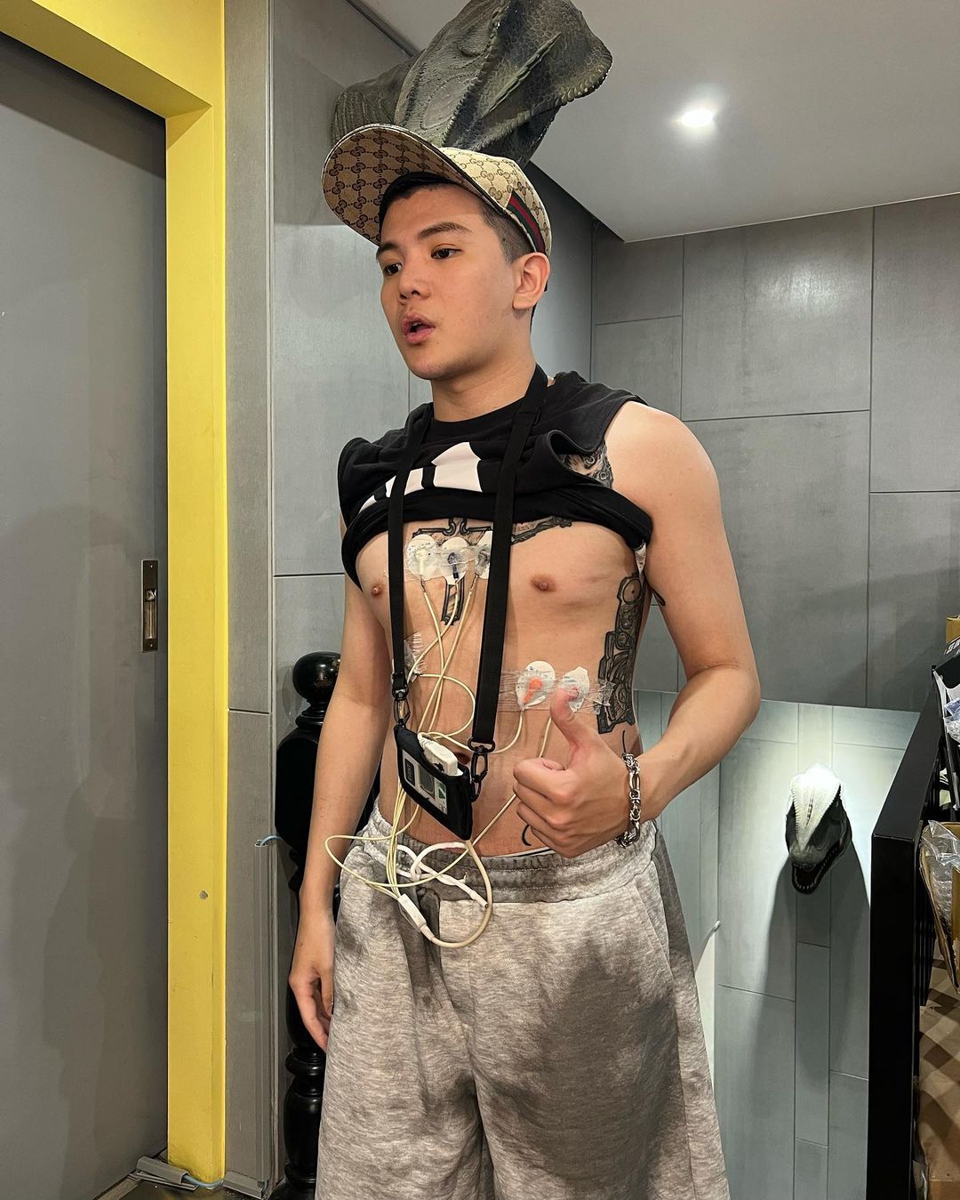 孫生罹患橫紋肌溶解症。 圖：翻攝自孫生IG(@soon6669)