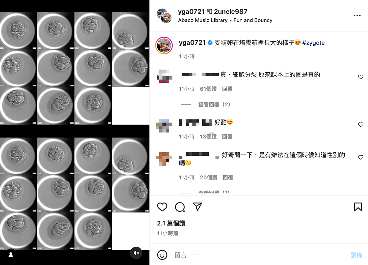 蔡阿嘎在IG曬出受精卵的發育過程。 圖：翻攝自蔡阿嘎IG(@yga0721)