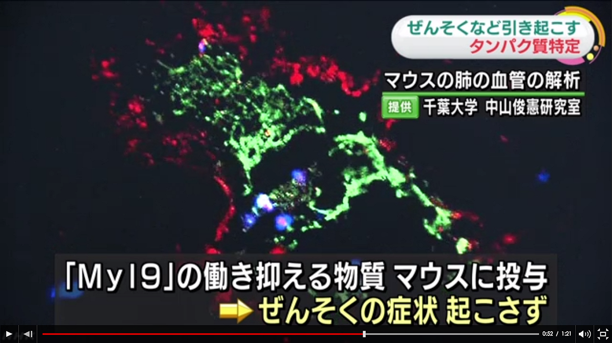 日本千葉大學研究團隊發表研究結果，找到引發氣喘等過敏疾病的特定關鍵蛋白質。 圖：日本千葉大學提供