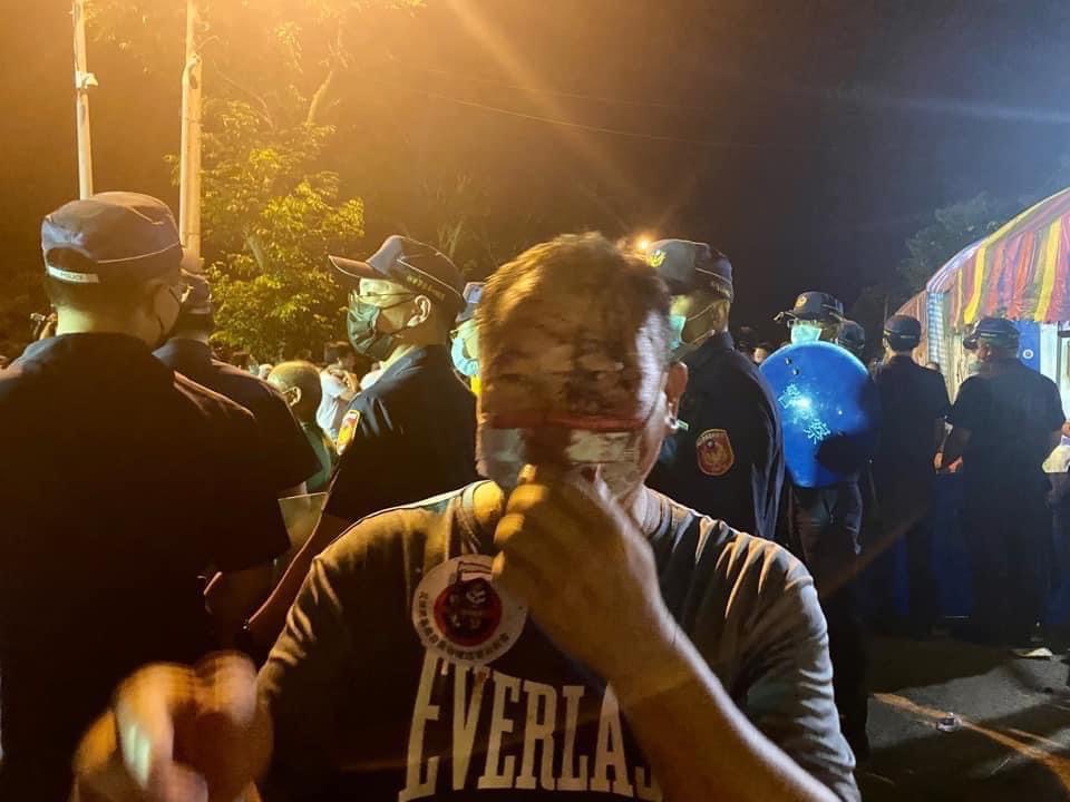 今晨3點抗議坤輿垃圾掩埋場的現場，竟出現黑衣人攻擊民眾，外界震驚。 圖：擷取自徐定禎臉書。