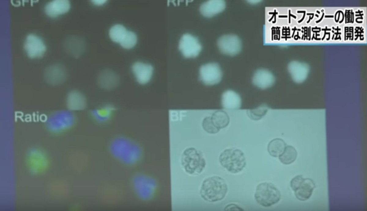 東京大學研究團隊研發出可以簡單測定細胞自噬機制的方法，可望有助於加速開發各種疾病新藥的臨床研究。 圖：翻攝自Youtube