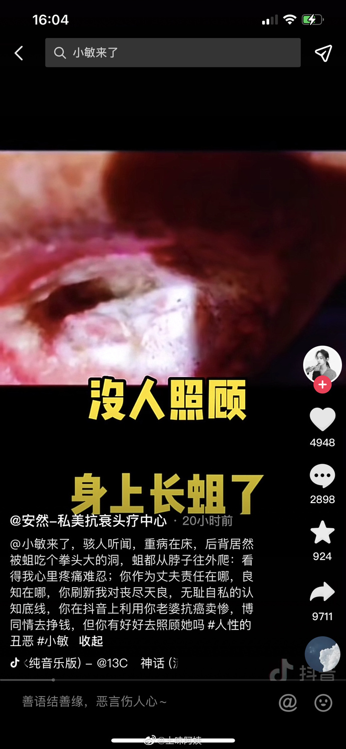 網傳「小敏來了」直播拍攝到小敏身上長蛆  圖: 翻攝自补果君 微博
