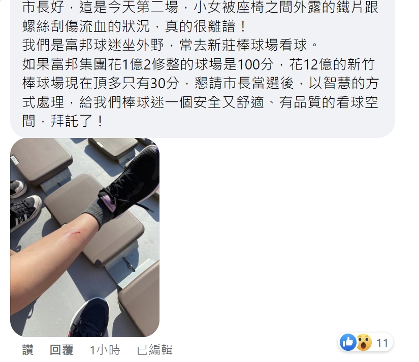 球迷被新竹市棒球場外野座位外露鐵片刮傷。 圖:高虹安臉書