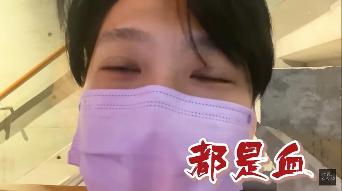 尼克表示陪產期間看到都是血差點暈倒。