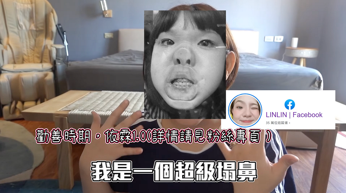 她也公開自己過去整形前的照片，自嘲自己是「自然醜」。
