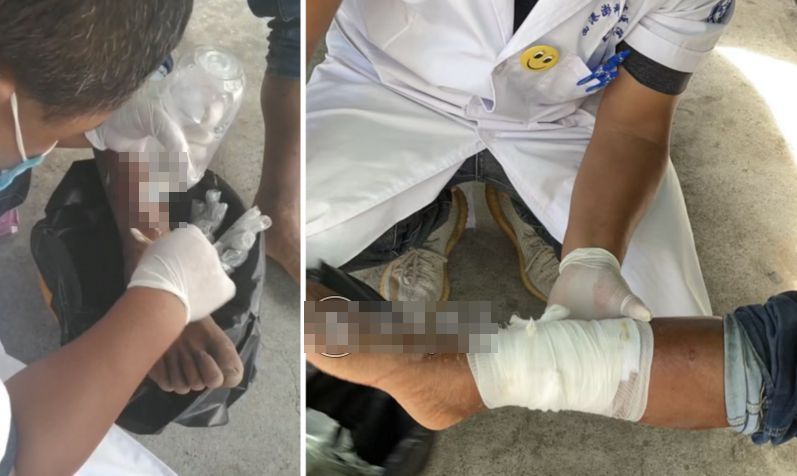 林姓男子在台商協助下就醫，當地醫護人員細心消毒、包紮腿部傷口。 圖：翻攝環球博訊
