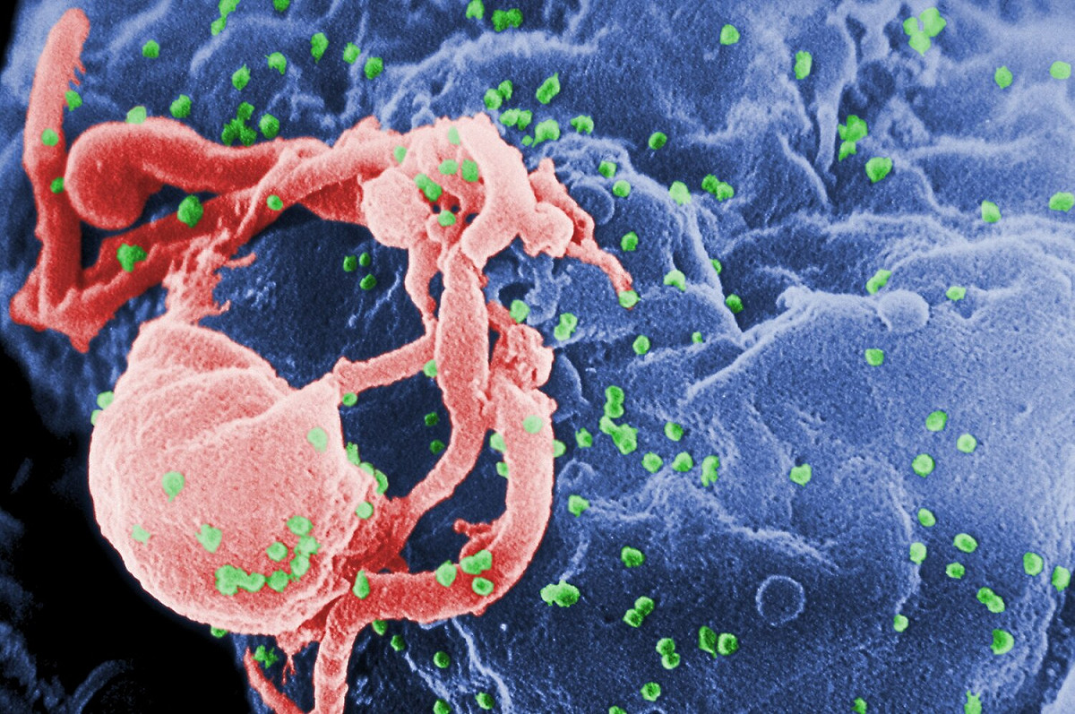 HIV愛滋病毒示意圖。 圖：翻攝自維基百科（資料照）