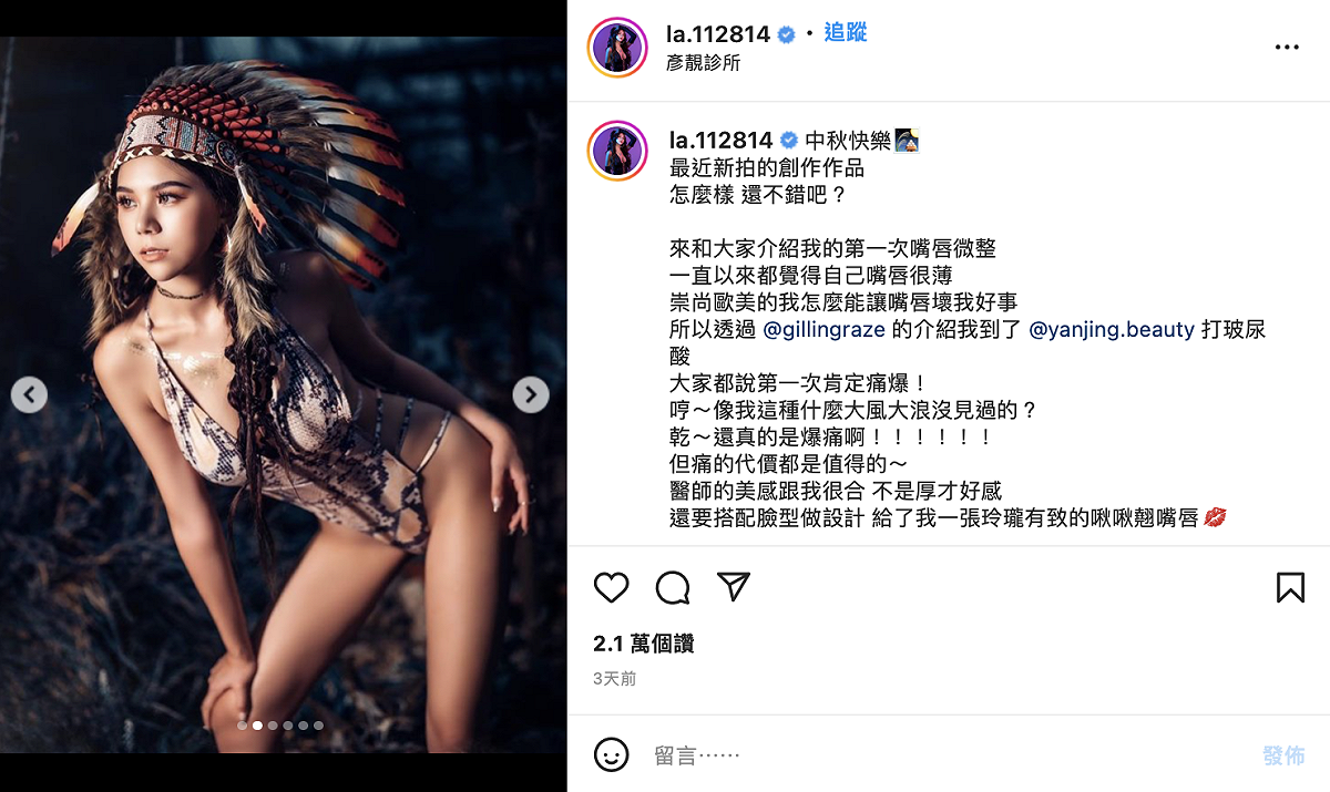 蕾拉也上傳多張美照，和粉絲分享豐唇效果。 圖：翻攝自蕾拉IG