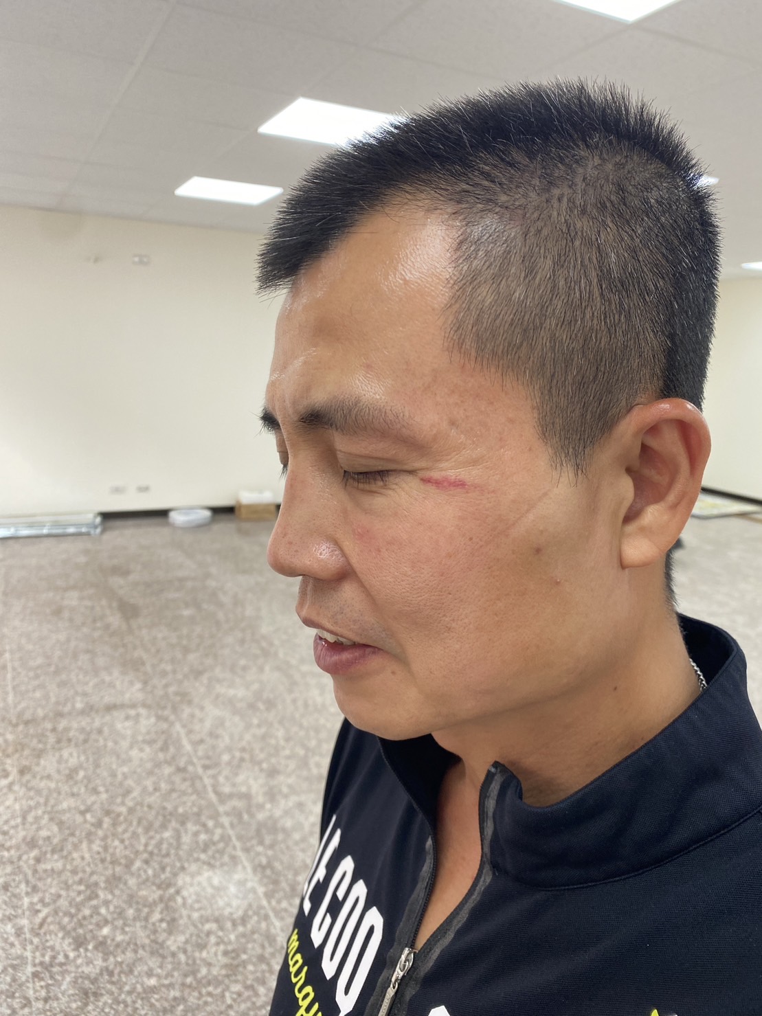 翁聖濰在里內巡邏時遭蒙面者以疑似槍托鈍器打傷，要他「不要再選了」。 圖：林金結辦公室提供