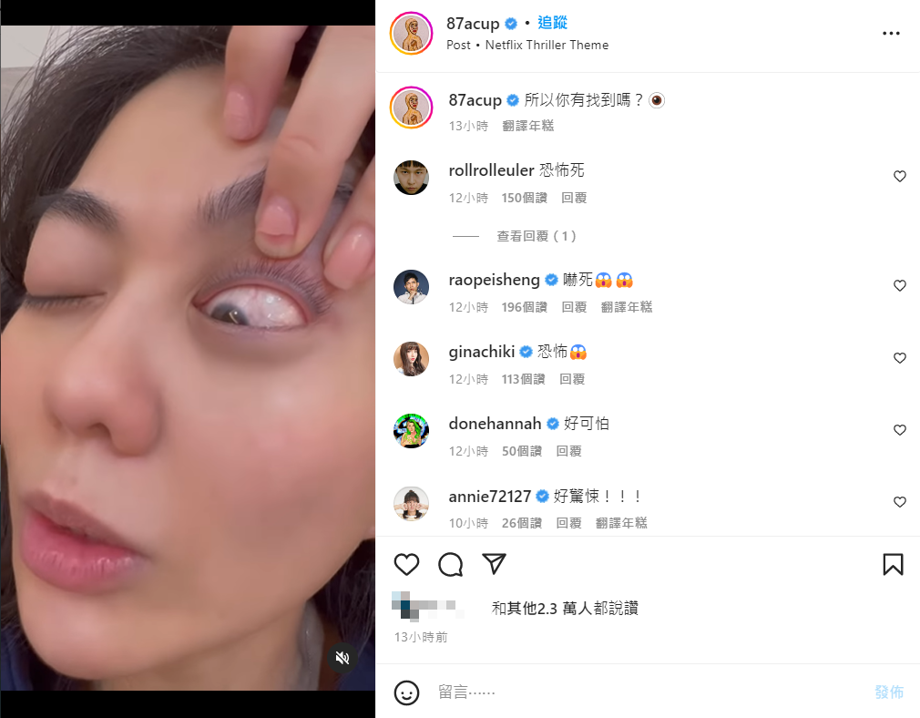 白癡公主隱形眼鏡破掉卡在眼睛。 圖：翻攝自IG/87acup