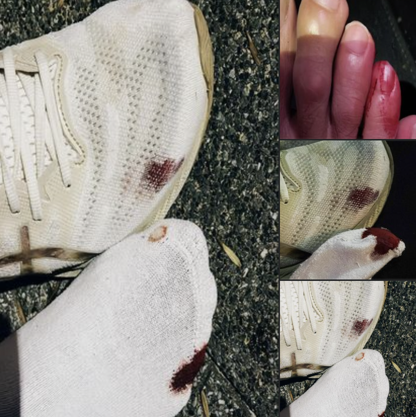 他秀出自己的腳傷，照片可見連白鞋都遭染紅。 圖：翻攝自郭彥均FB