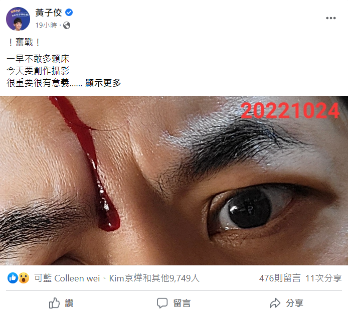 黃子佼頭部因被藝術品砸中流血。 圖：翻攝自臉書/黃子佼
