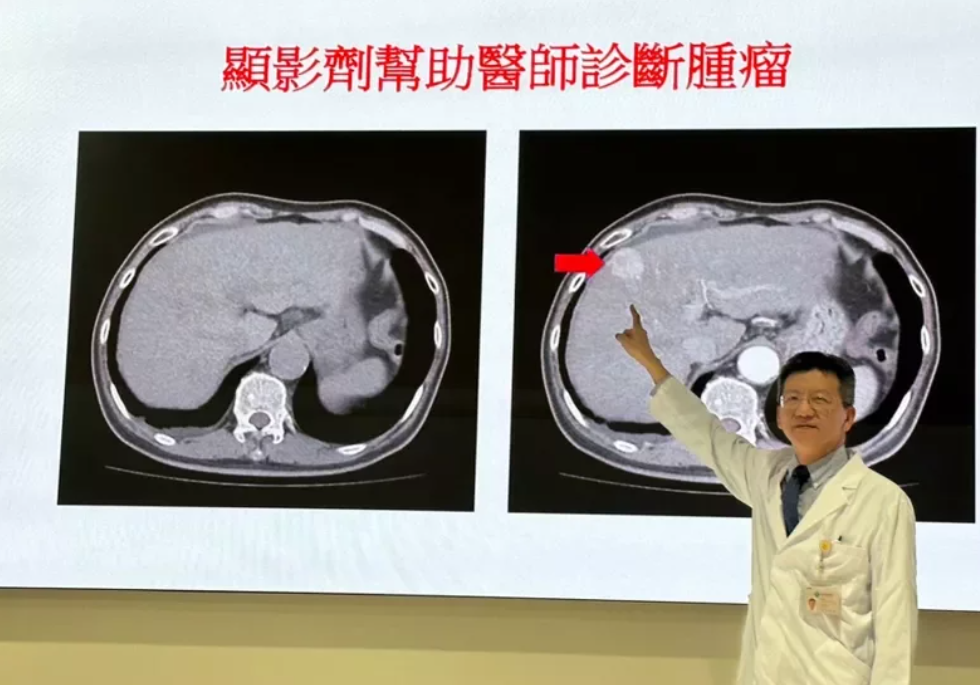 昨日台中榮總發布一份與國衛院合作的最新研究，首度發現電腦斷層造影CT、磁振造影(MRI)使用到的顯影劑與失智症有關。（圖為台中榮總內科部主任吳明儒） 圖：台中榮總提供