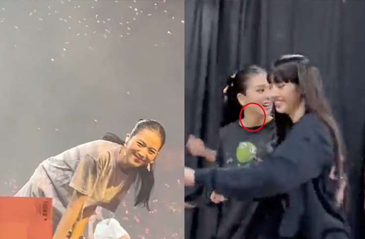 不過最新畫面曝光，目前腫塊已消失讓眾人鬆了口氣。