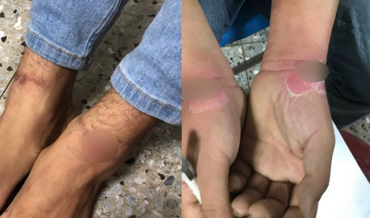 被囚禁的被害者遭手銬、腳鐐銬住多日，四肢都已破皮流血。 圖:翻攝自影片