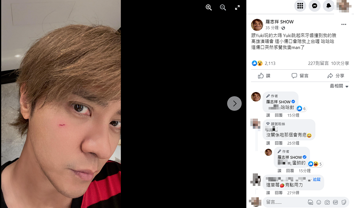 羅志祥表示12日會帶著傷口上台開唱。 圖：翻攝自羅志祥臉書