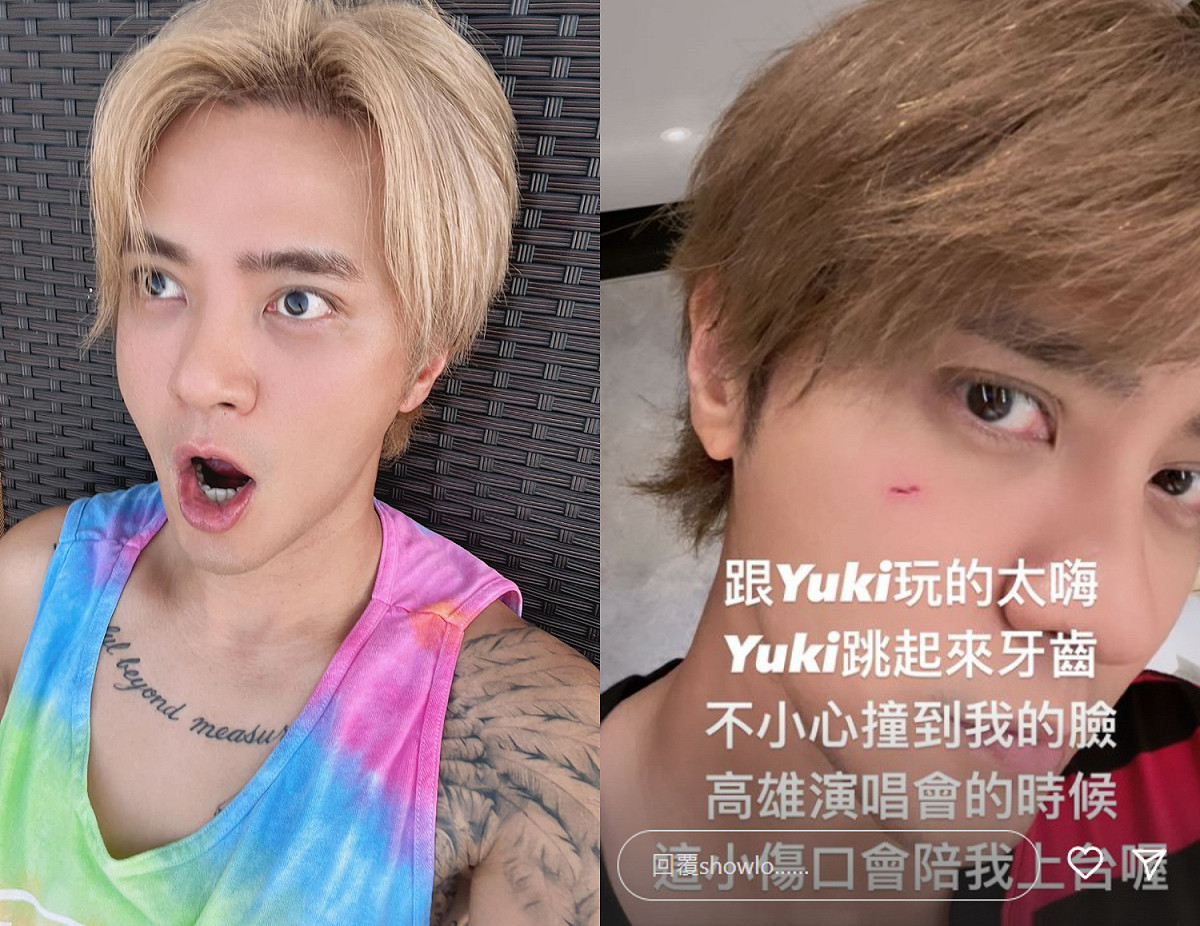 羅志祥臉頰被愛犬不小心弄傷。 圖：翻攝自羅志祥臉書、IG