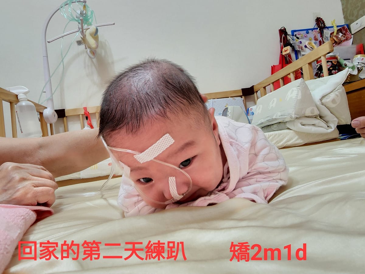 低、極低出生體重兒(俗稱巴掌仙子)出生時各個器官尚未成熟，與足月生的寶寶相比，較容易發生心肺功能、視網膜及神經發展等問題。 圖：國民健康署／提供