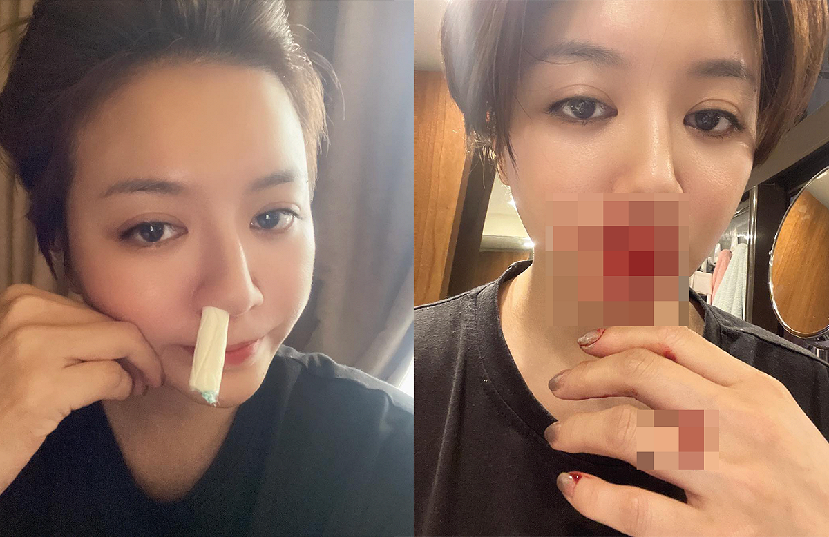 藝人李妍憬突曝滿臉鮮血照，嚇壞網友。 圖：翻攝自李妍憬FB