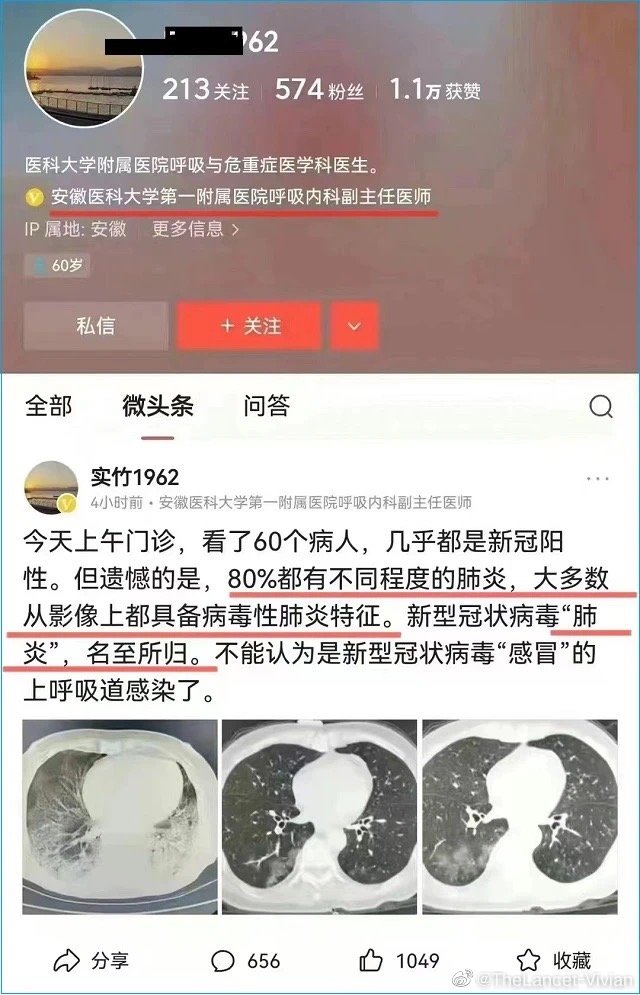 網傳許多「大白肺」圖片，中共官方趕緊闢謠。 圖：翻攝自搜狐（資料照）