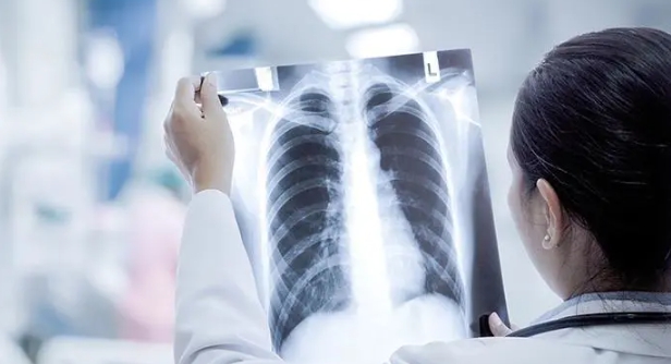 中國網路瘋傳大白肺的CT 圖。 圖 : 翻攝自澎派新聞