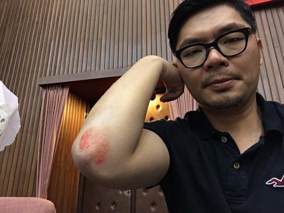 圖說:許毓仁5日透過臉書發文表示，立委吳秉叡為了佔主席台，衝上前將他推倒，導致他手肘擦傷。  圖:截圖自許毓仁臉書
