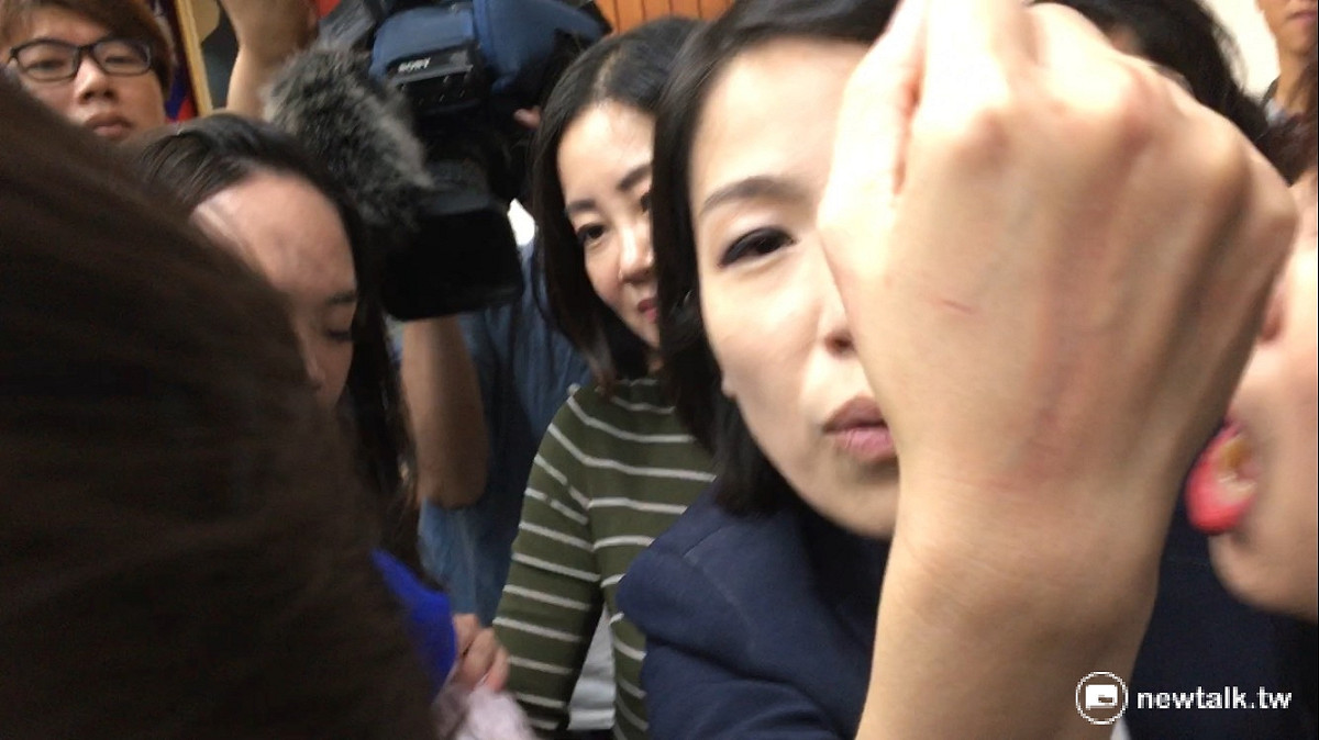 民進黨立委余宛如秀出被抓傷的手背。 圖：鍾孟軒/攝