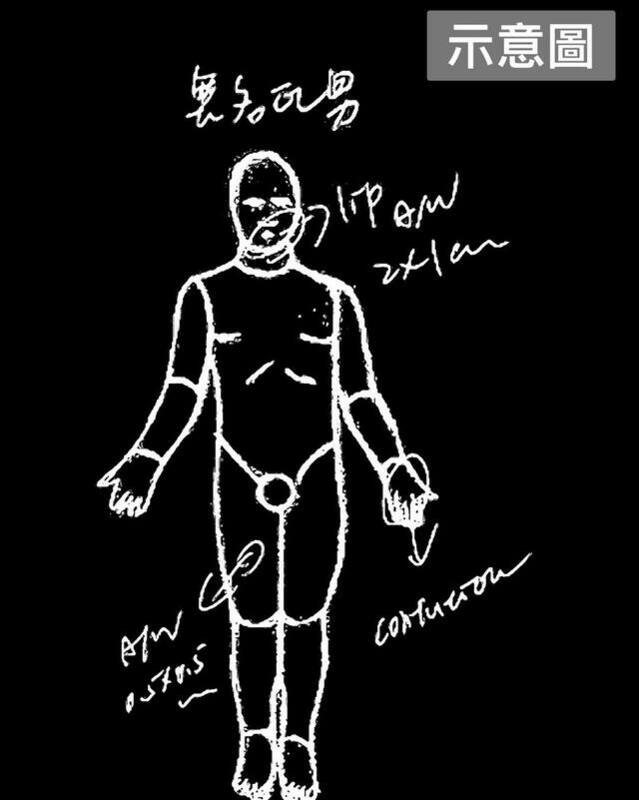高大成於臉書上張貼5億高中生檢傷單示意圖，質疑有心人刻意將「墜樓死亡」深植人心，再說成他跳樓自殺。 圖：擷取自高大成臉書