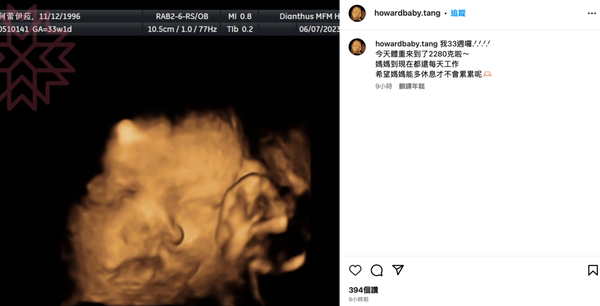 蕾菈昨晚也在兒子的IG帳號曬出超音波照，並以兒子的視角發文。 圖：翻攝自IG＠howardbaby.tang