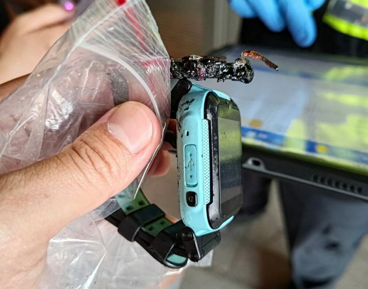 新北消保官表示，一名男童戴的智慧手錶發生爆炸，造成傷害。經查，該手錶的品牌是「Hero watch」。 圖：民眾提供