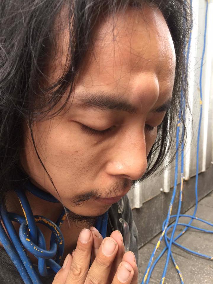 志工將發電機延長線纏在自己身上阻擋施工，遭工頭衝撞導致頭部受傷腫起。 圖：翻攝自「松菸護樹」臉書
