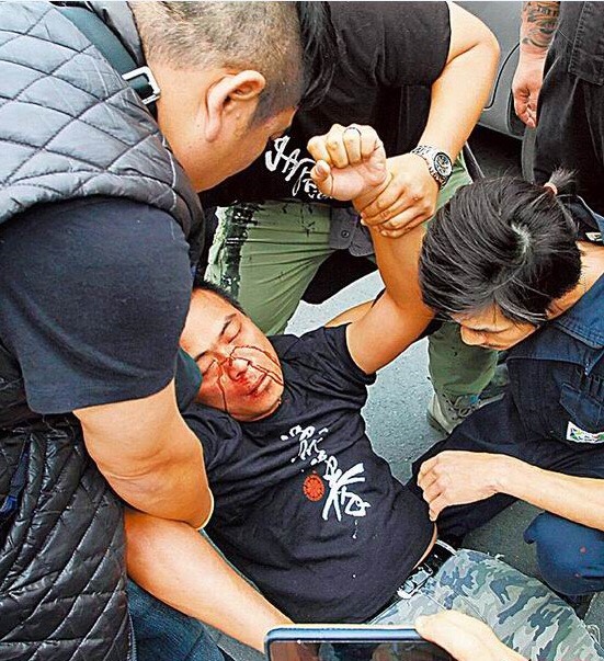 動保團體成員5月20日被政治人物率眾圍毆到滿臉是血。 圖：NOE提供