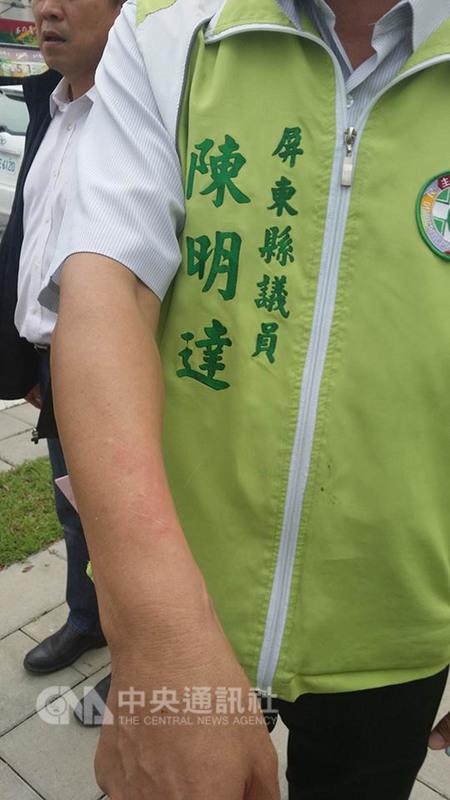 總統府音樂會28日下午在屏東演藝廳舉行，年金改革抗 議團體聚集數百人抗議，音樂會結束後，民進黨籍屏東 縣議員劉育豪、陳明達等人在路邊等車，遭抗議群眾朝 他們丟瓶子，陳明達被丟到手臂淤傷。 （劉育豪提供） 中央社　 圖:中央社