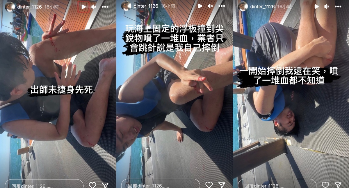 近日他回到老家澎湖，沒想到，玩水上活動時不慎出意外，傷口像湧泉一樣噴血。 圖：翻攝自IG＠dinter_1126