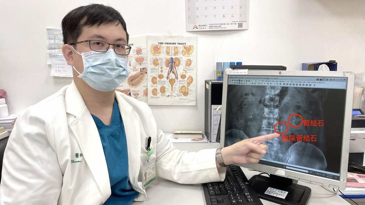恩主公醫院泌尿科莊德彥醫師指出，軟式輸尿管鏡雷射碎石手術可以一次清理輸尿。  圖：恩主公醫院／提供