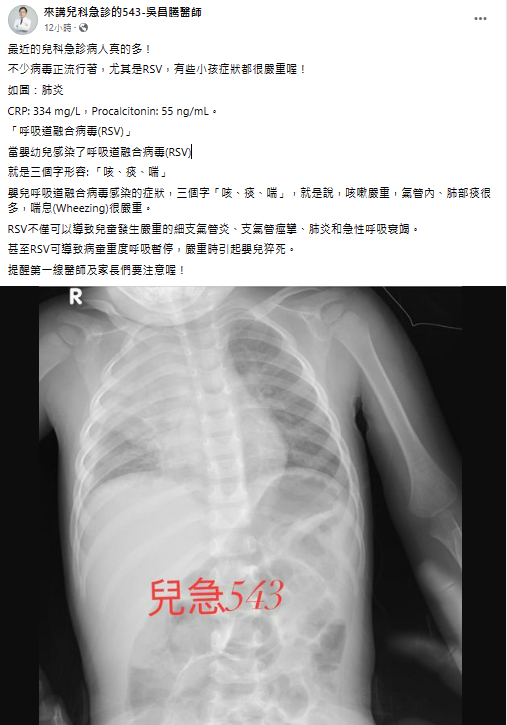 兒科急診醫師吳昌騰在臉書發文表示，嬰幼兒若染「呼吸道融合病毒」(RSV)最令人擔心，尤其「咳、痰、喘」等嚴重症狀時，可能會危及性命。 圖：翻攝自「來講兒科急診的543-吳昌騰醫師」臉書專頁