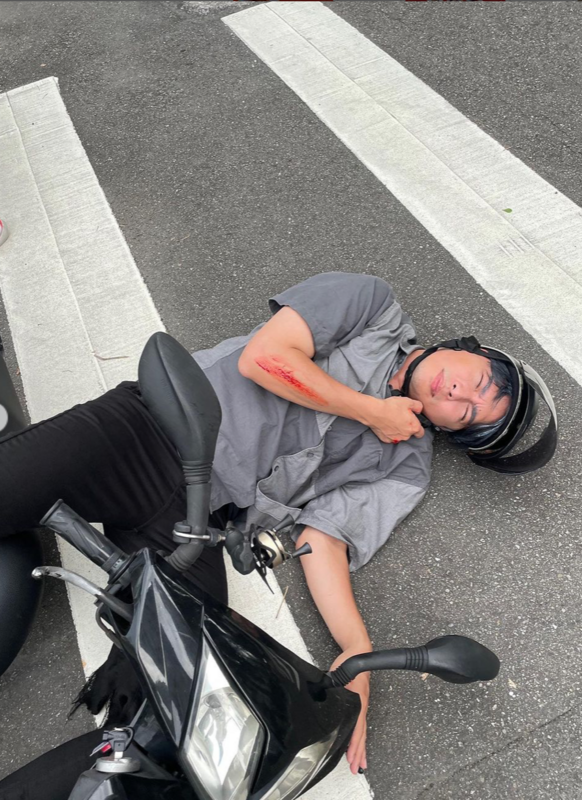 石頭的右手前臂擦出一大片傷口，甚至有明顯流血。 圖：翻攝自IG＠thisgroupofpeople