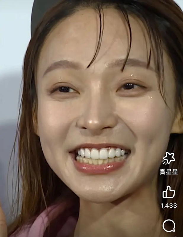 近日林襄被網友發現牙齒「上白下黃」色差嚴重。 圖：翻攝自Dcard
