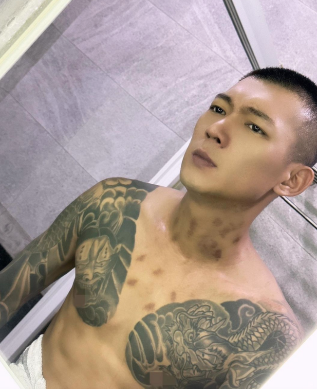 鳳梨曬出裸上半身的照片，並提到起床後發現身上出現「不明印記」。 圖：翻攝自吳泓逸IG