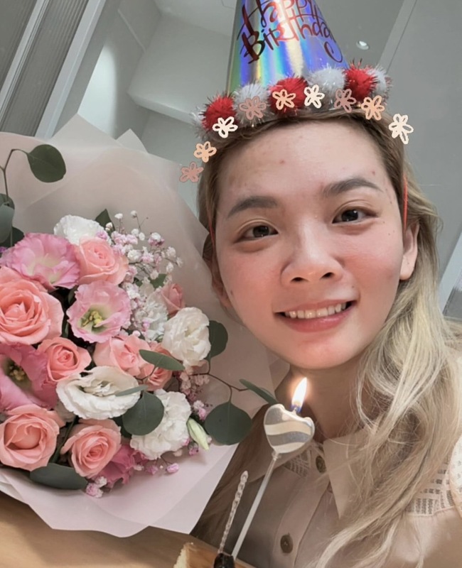 日前滴妹額頭冒出了幾顆痘痘，讓人擔心是不是工作太過勞累。對此，滴妹也無奈坦承「最近壓力大一直長痘痘，可能內分泌失調」。 圖：翻攝自滴妹IG