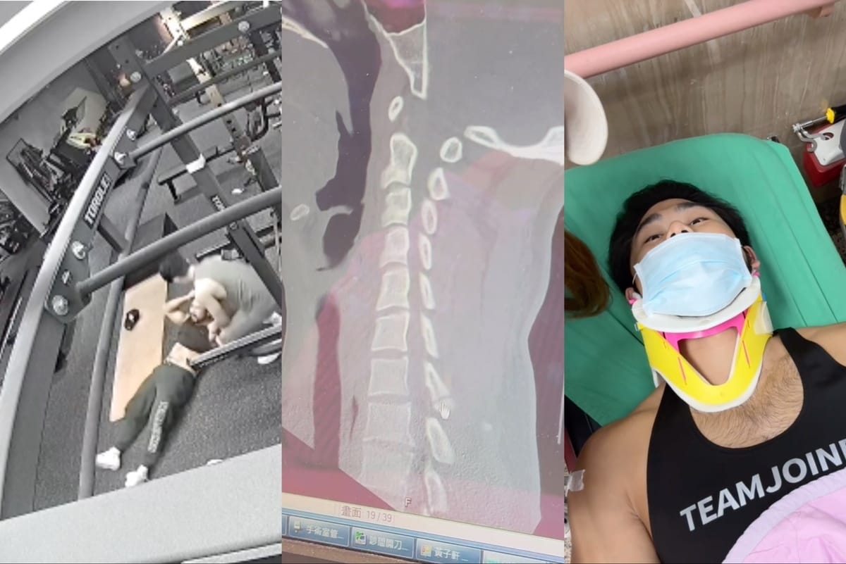 從脖子的X光片可以清楚看見他的頸椎其中一節裂開，傷勢相當嚴重。 圖：翻攝自IG＠peeta.gege