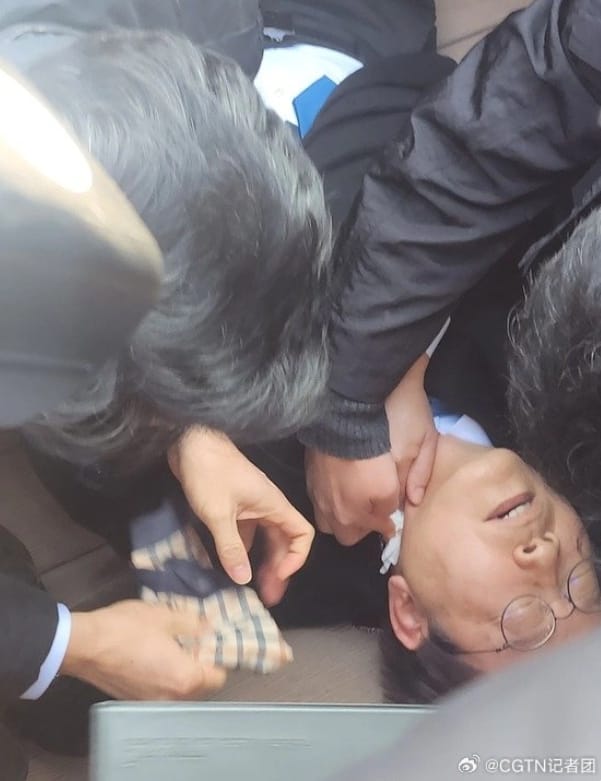 南韓最大在野黨黨首李在明今 ( 2 ) 日上午，在釜山出席活動時遇襲。現場人員止血搶救。 圖 : 翻攝自CCTV國際時訊