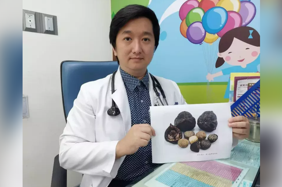 大千綜合醫院小兒科醫師詹裕仁說，油桐子有毒，誤食會有多種症狀，且無解毒劑，只能靠洗胃輸液緩解症狀。 圖：大千綜合醫院／提供