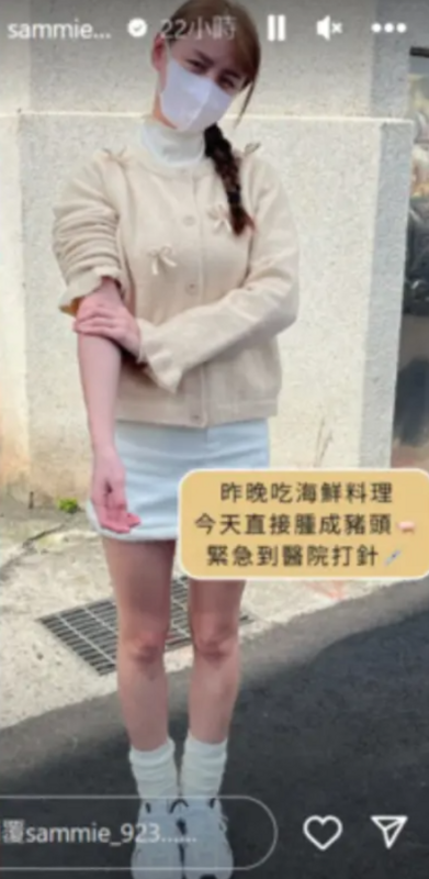 短今疑似昨日吃了海鮮料理而過敏，導致整個人「腫成豬頭」，緊急送醫治療。 圖：翻攝自短今IG