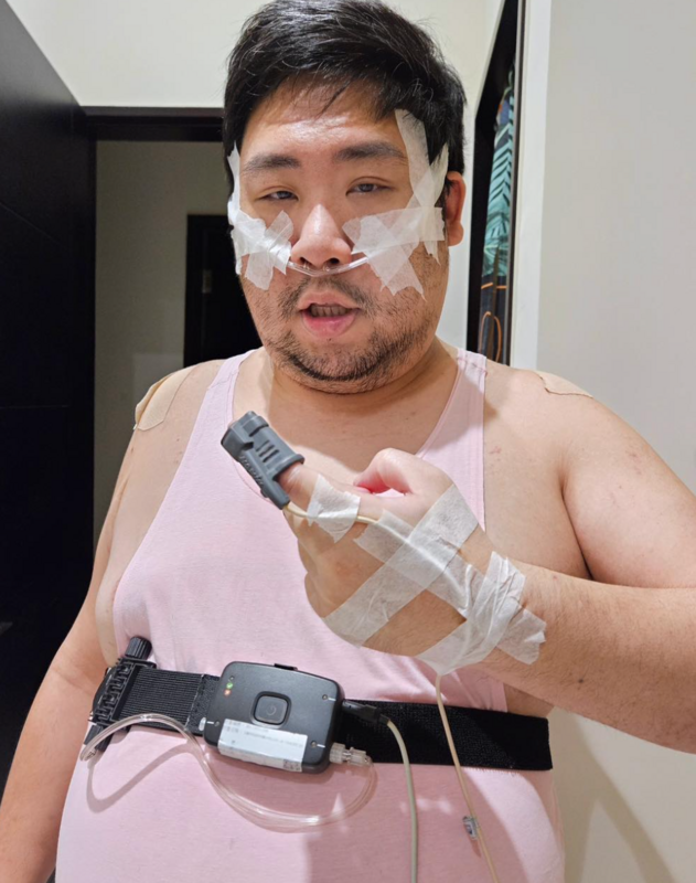 國動昨日突曬出鼻子插管、手指夾著檢測儀器的照片，嚇壞不少粉絲。 圖：翻攝自國動IG
