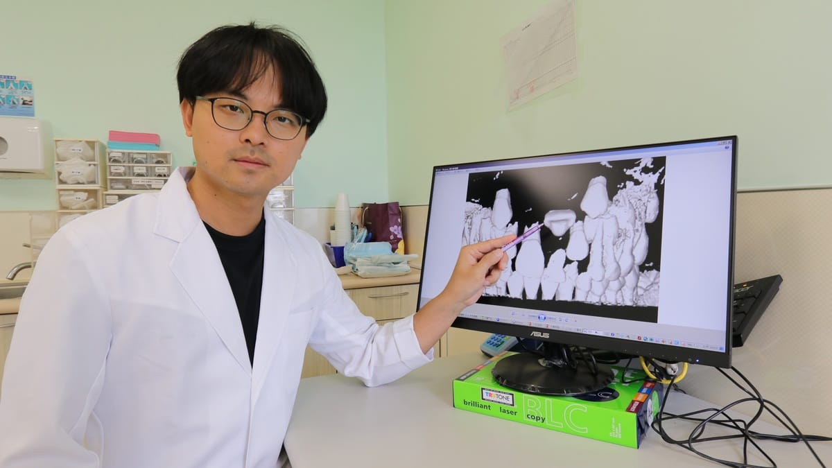 醫師提醒家中若有國小三年級幼童正中門牙仍未萌發，務必儘速就醫檢查。 圖：亞大醫院/提供